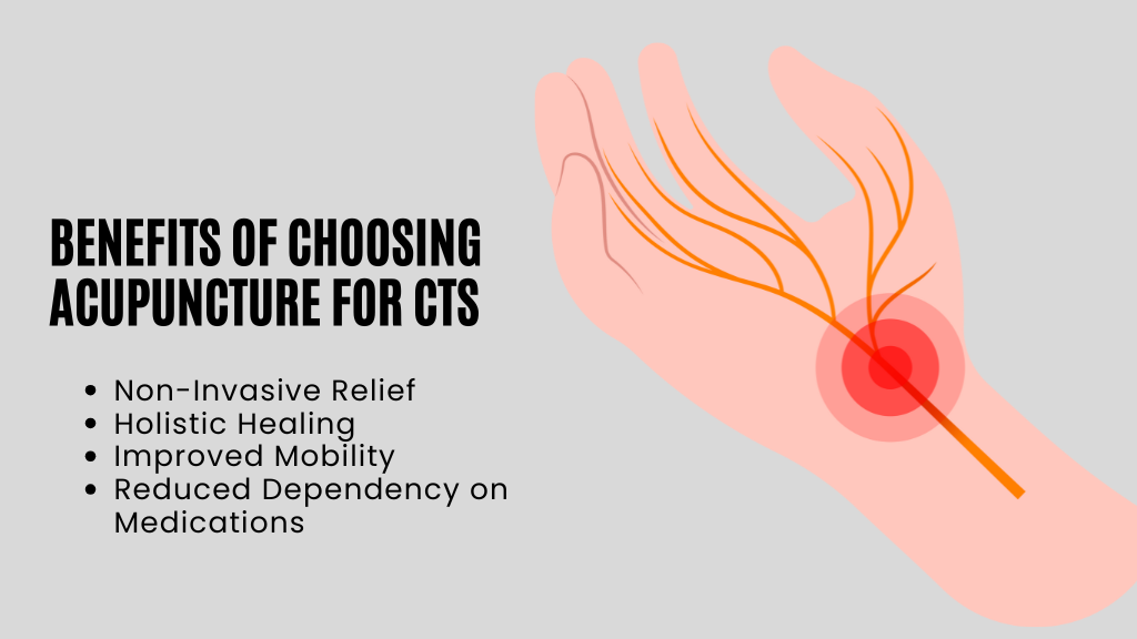 Benefits of Choosing Acupuncture for CTS