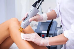 Laser Hair Removal Packages Dubai