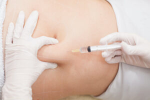 Is Fat Melting Injections Painful Compared to Other Methods?