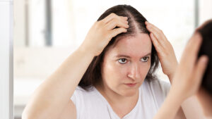 Is Hair Replacement a Good Option for Women Too?