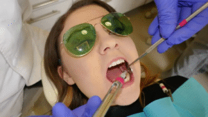 Tooth Filling Cost in Dubai
