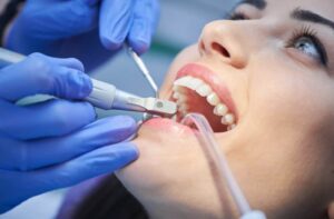 Best Dental Clinic in Dubai