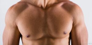 gynecomastia male breast