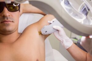 Painless Full-Body Laser Hair Removal in Dubai