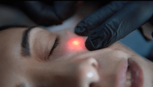 Endolift in Dubai