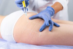 How Painful Are Fat Dissolving Injections Really?