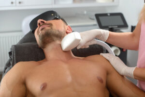 How Permanent Is Men’s Laser Hair Removal Treatment