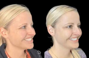 Step-by-Step Guide to the Best Aesthetic Clinic in Dubai for Botox Sessions