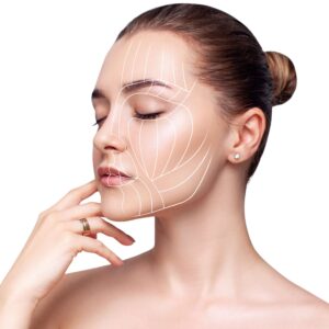 Endolift