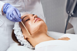 Cold Peel