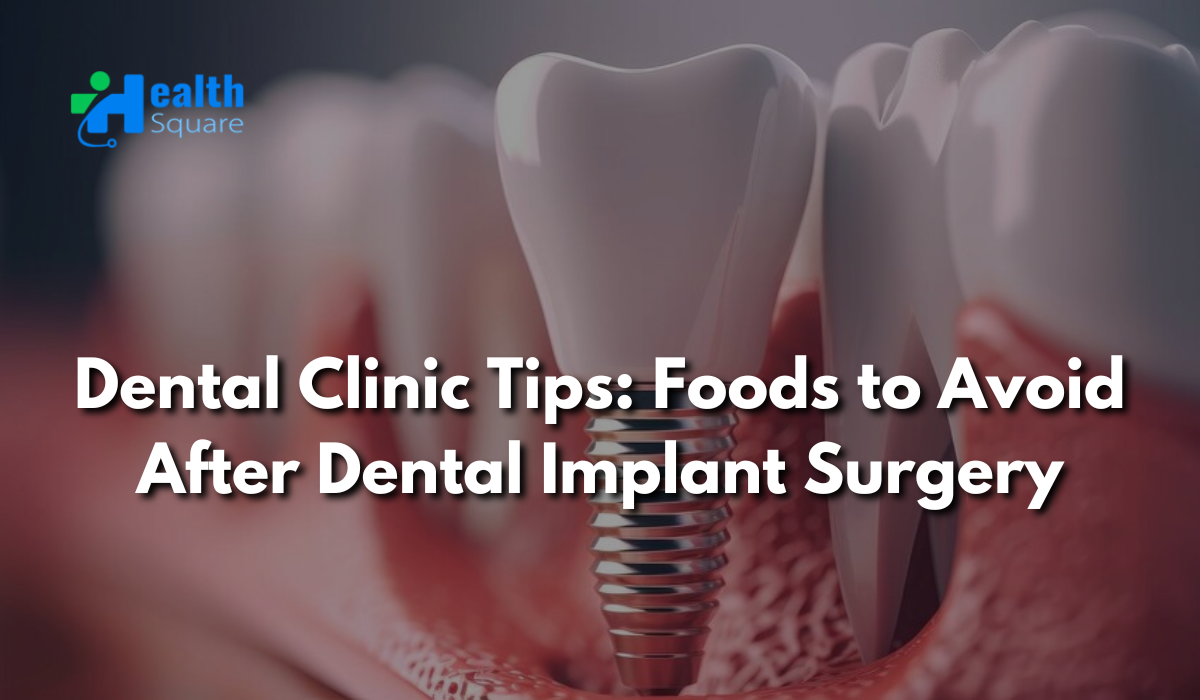 Dental Clinic Tips: Foods to Avoid After Dental Implant Surgery