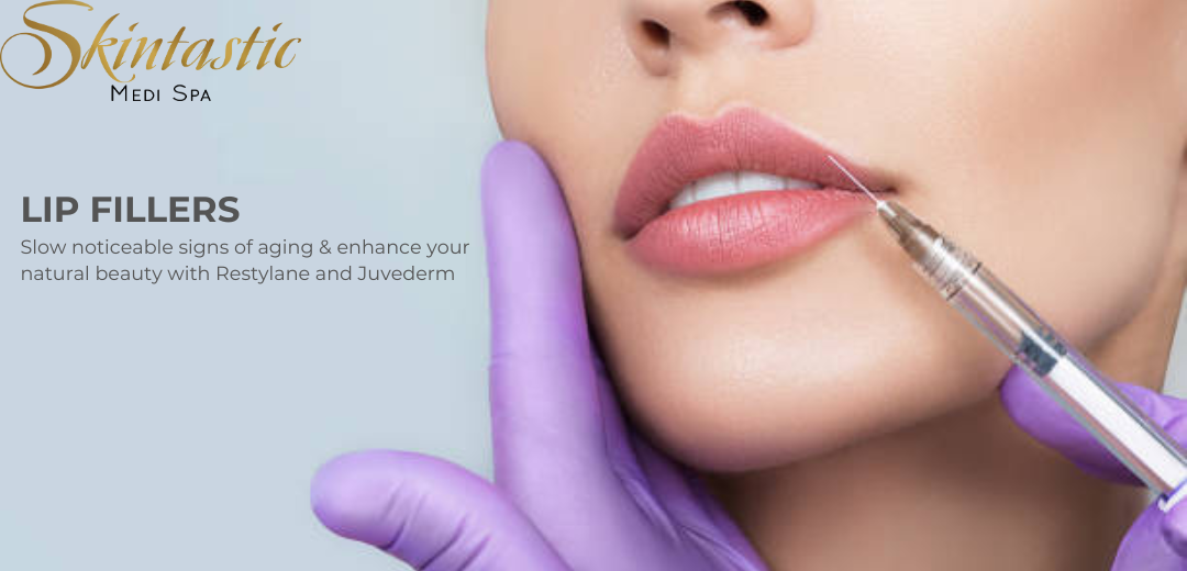 Lip Fillers Treatment in Riverside