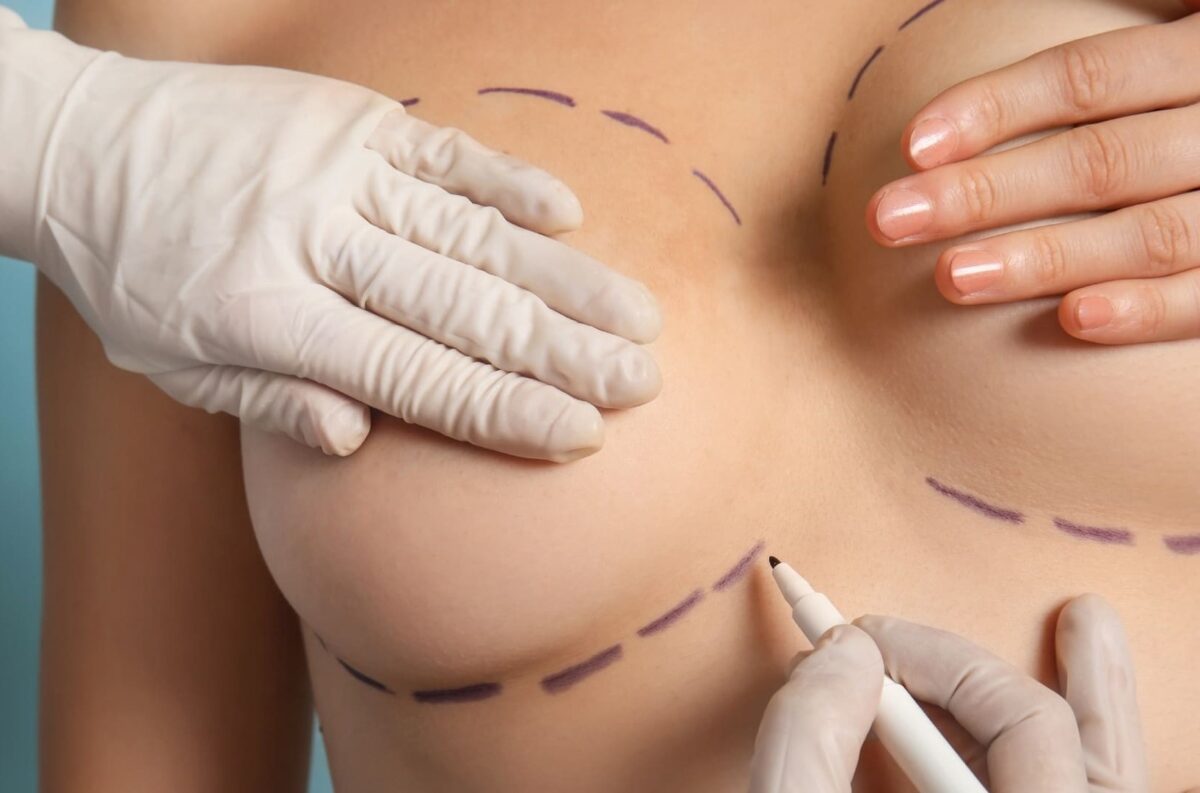 Breast Fat Transfer