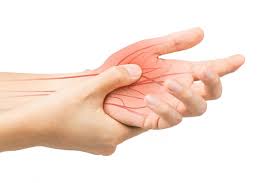 showing a nerve pain in a hand.