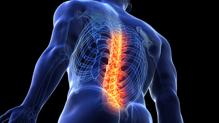 Stem Cell Therapy for Spinal Cord Injury