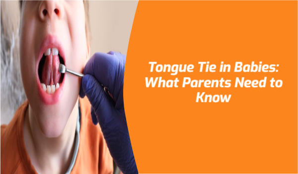 Tongue Tie Treatment