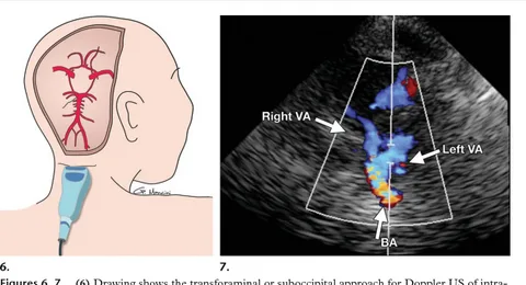 Real-time Doppler ultrasound