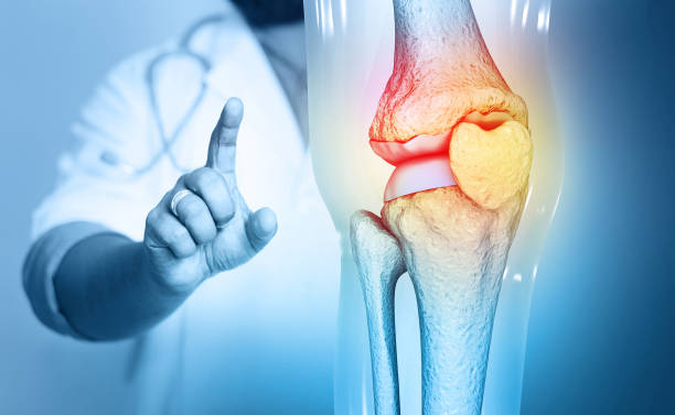 Top Osteoarthritis Therapies: Effective OA Treatment & Therapy Options