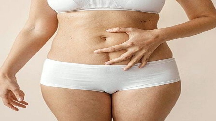 Transforming Your Silhouette: A Guide to Tummy Tuck Surgery in Islamabad