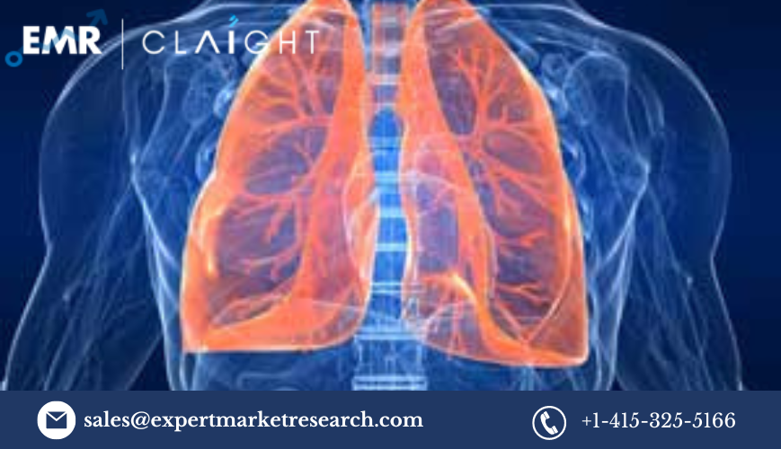 The Acute Lung Injury Treatment Market: Trends, Growth, and Key Players 2032