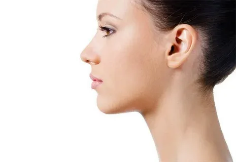 Chin Liposuction in Dubai