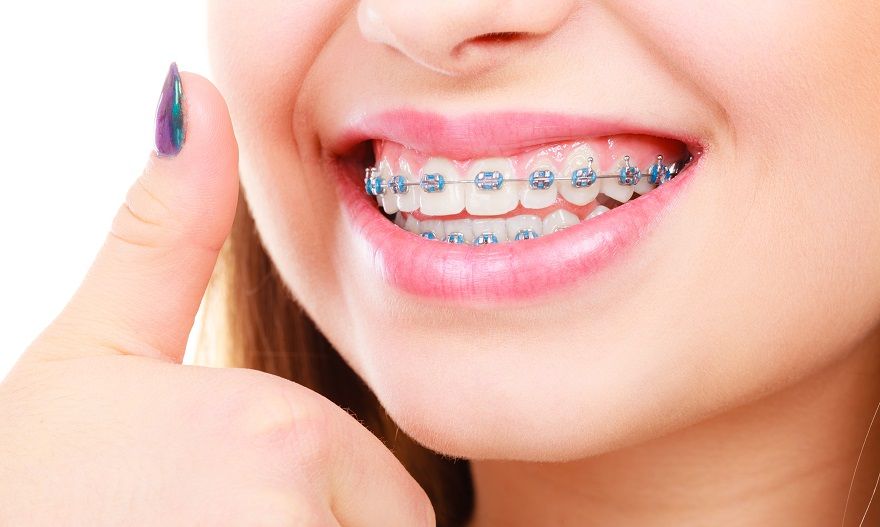 Top 7 Myths About Orthodontic Treatment in Mill Park