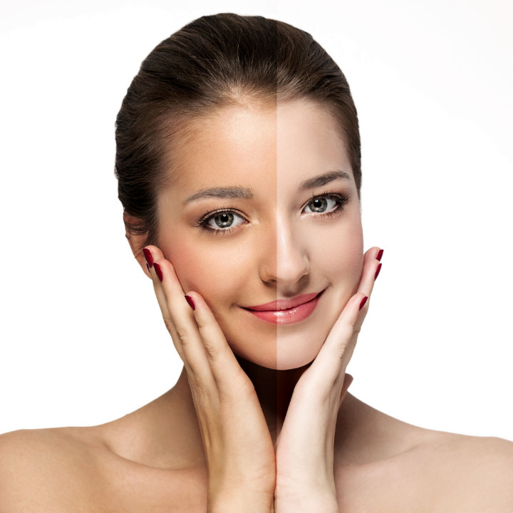 Skin Whitening in Dubai: Top Treatments for 2024