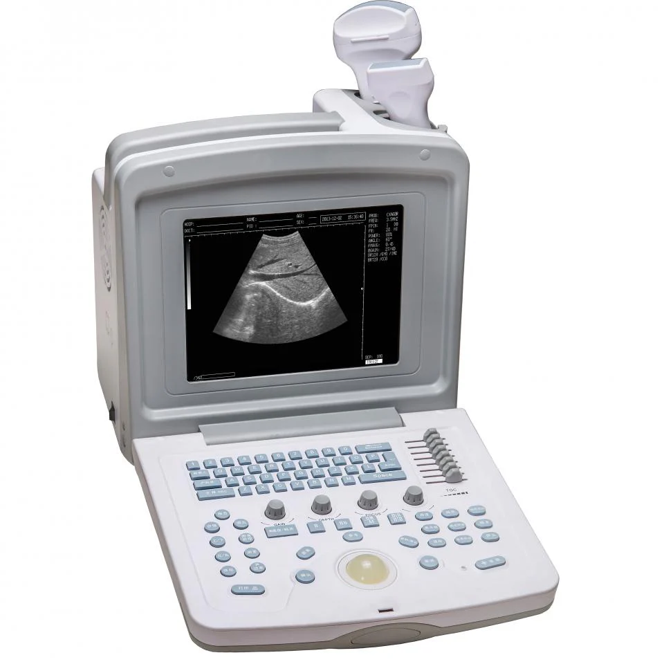 Laptop Ultrasound machine price in Pakistan