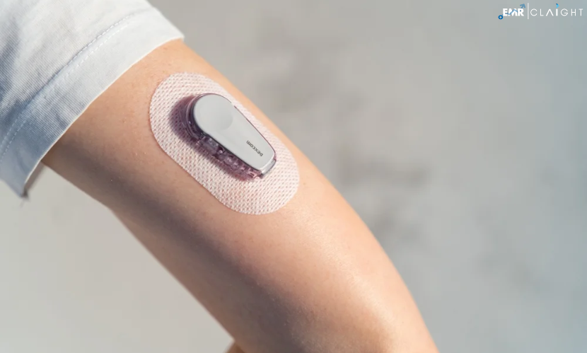 North America Continuous Glucose Monitoring Market Share, Size, Trends, Drivers, & Future Outlook | 2024 – 2032