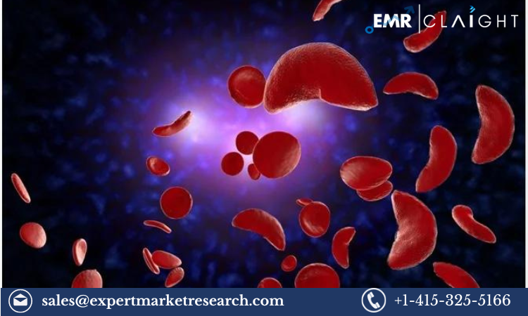 Sickle Cell Disease Treatment Market: Growth, Trends & Key Players (2024-2032)