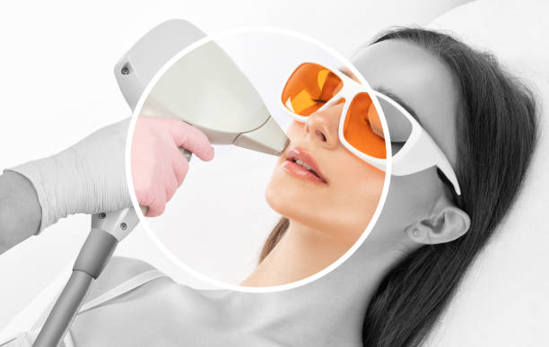 "From Stubble to Smooth: The Ultimate Guide to Permanent Laser Hair Removal"