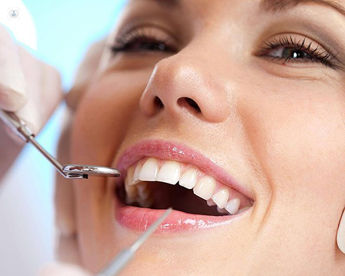 Rediscover Your Smile: The Transformative Power of Dental Implants in Odessa