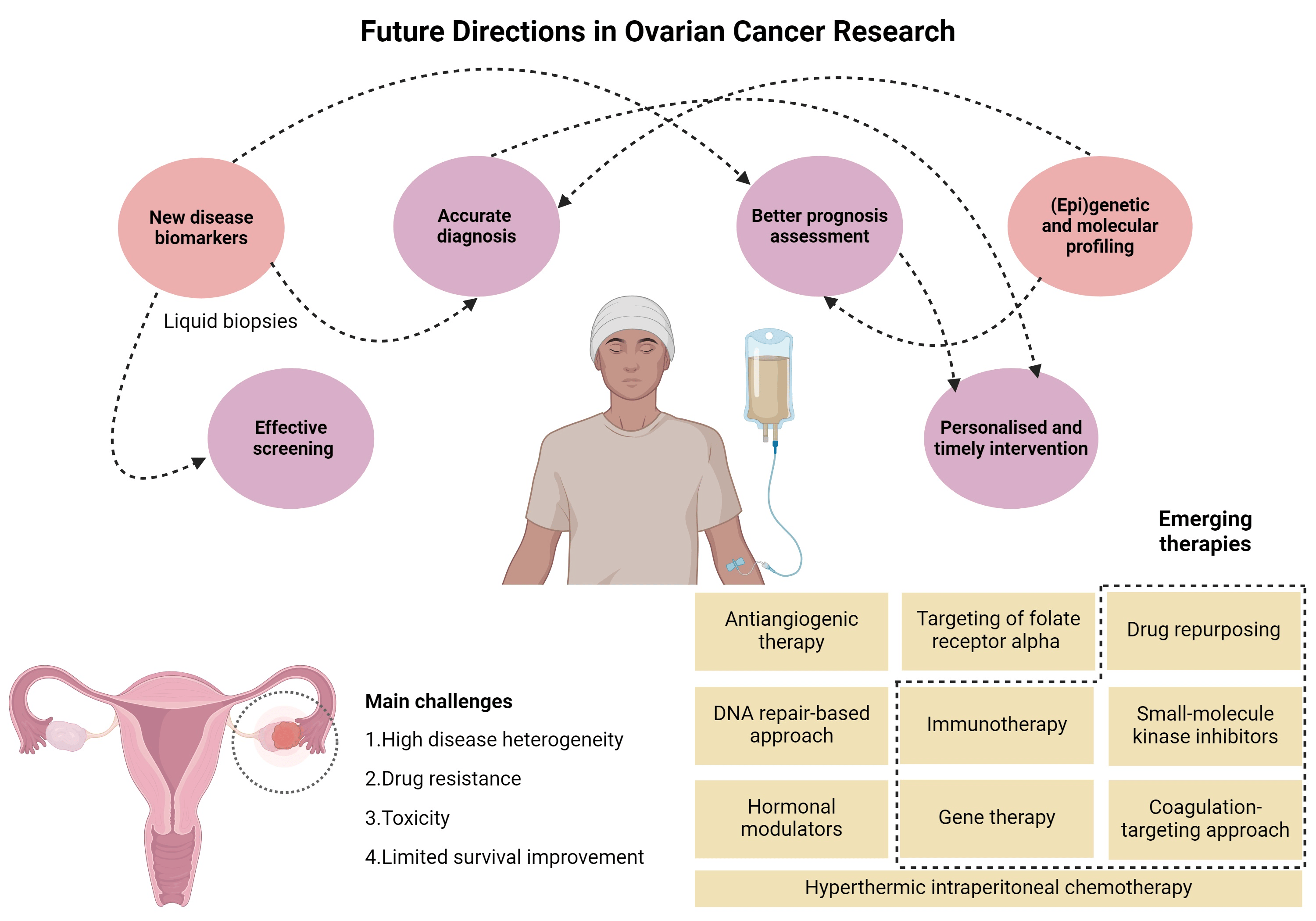 Ovarian Cancer Drug Pipeline Analysis