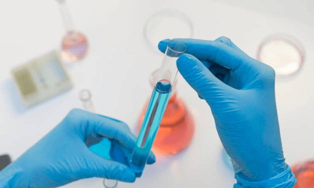 How to Prepare for a Lipid Profile Test: A Complete Guide