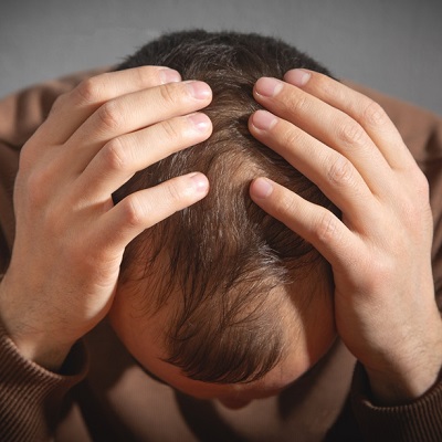 Is It Normal to Lose Hair After a Hair Transplant?