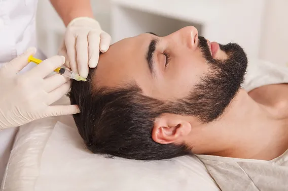 Hair Transplant in Islamabad