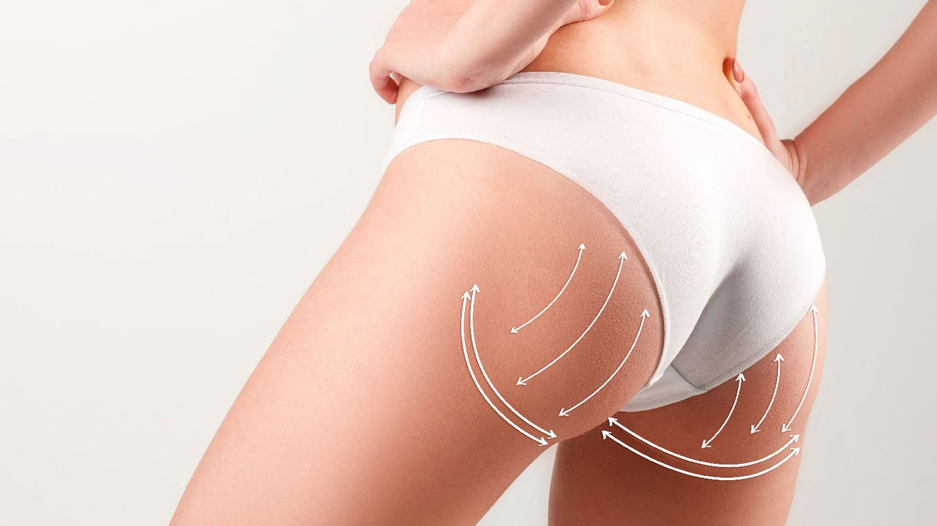 How Butt Fat Transfer Surgery in Dubai Enhances Your Body Contour