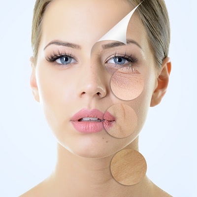 How to Maintain Smooth Skin After Wrinkle Treatments in Islamabad