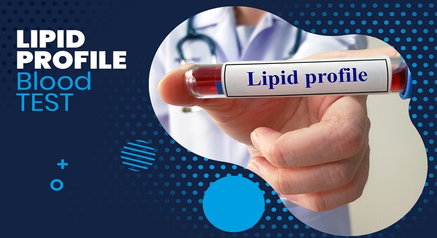 Lipid Profile Test