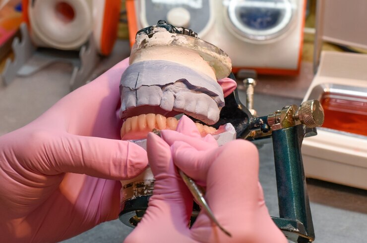 Transforming Smiles: The Full Mouth Reconstruction Approach Tailored Solutions