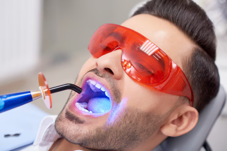 teeth whitening foley al