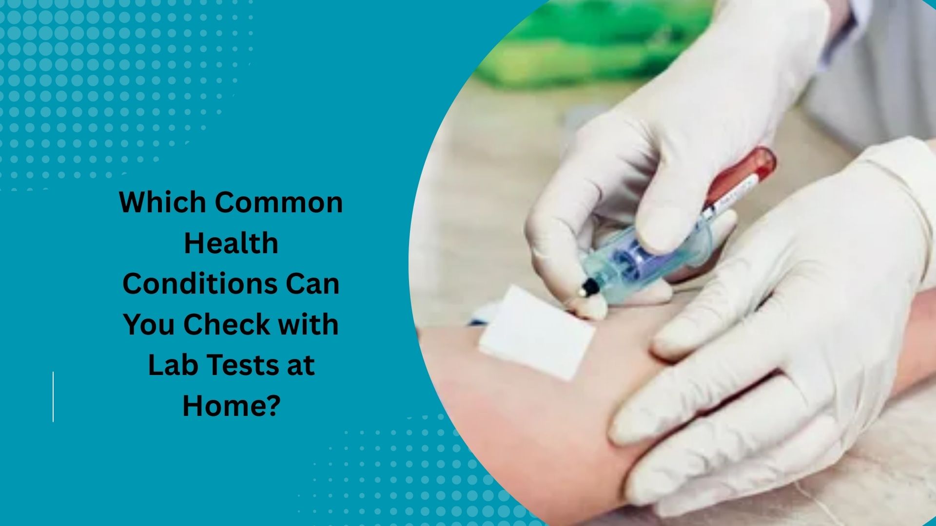 Which Common Health Conditions Can You Check with Lab Tests at Home?