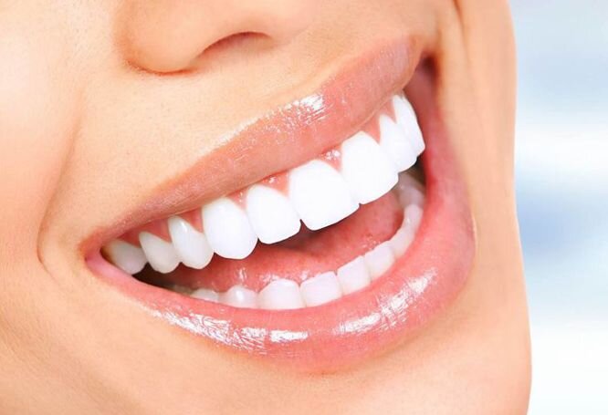 Cosmetic Dentistry in Perth: Transforming Smiles with Expertise