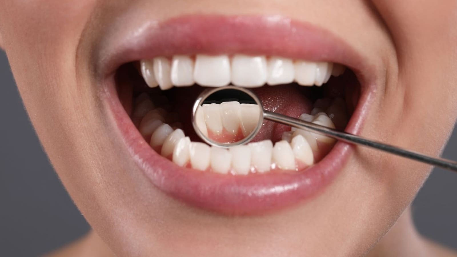 Dental Implants - A Long-Term Investment in Your Oral Health