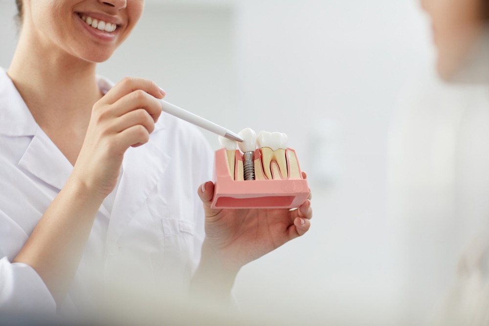 Dental Implants - The Advanced Solution For Tooth Replacement