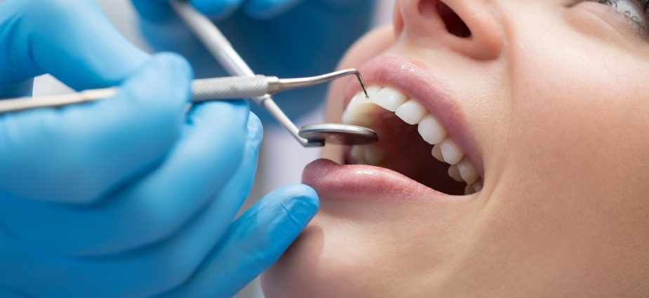 Dental Care Services Offered by a General Dentist