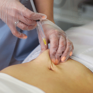 Fat Melting Injections