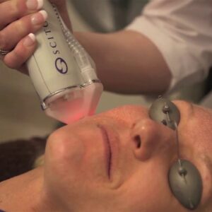 Halo Laser for Sun Damage and Acne Scars