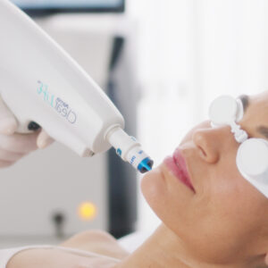 ClearLift laser Dubai