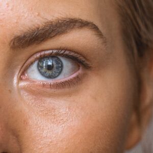 How to Get Lasting Results from Dark Circles Treatment